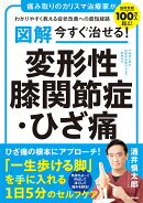 図解　今すぐ治せる！　変形性膝関節症・ひざ痛