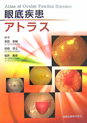 楽天ブックス: 眼底疾患アトラス - 吉田晃敏 - 9784307351270 : 本