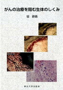 がんの治療を阻む生体のしくみ
