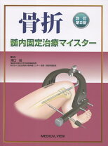 楽天市場】プレート 骨折 マイスター（本・雑誌・コミック）の通販