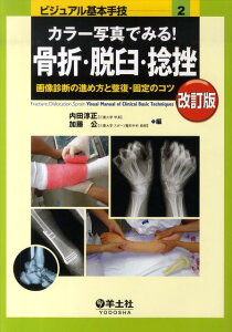 カラー写真でみる!骨折・脱臼・捻挫改訂版 画像診断の進め方と整復・固定のコツ (ビジュアル基本手技) [ 内田淳正 ]