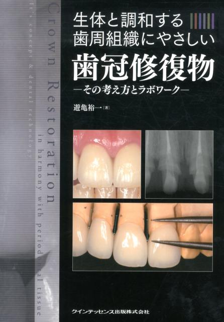 楽天ブックス: 生体と調和する歯周組織にやさしい歯冠修復物 - その 