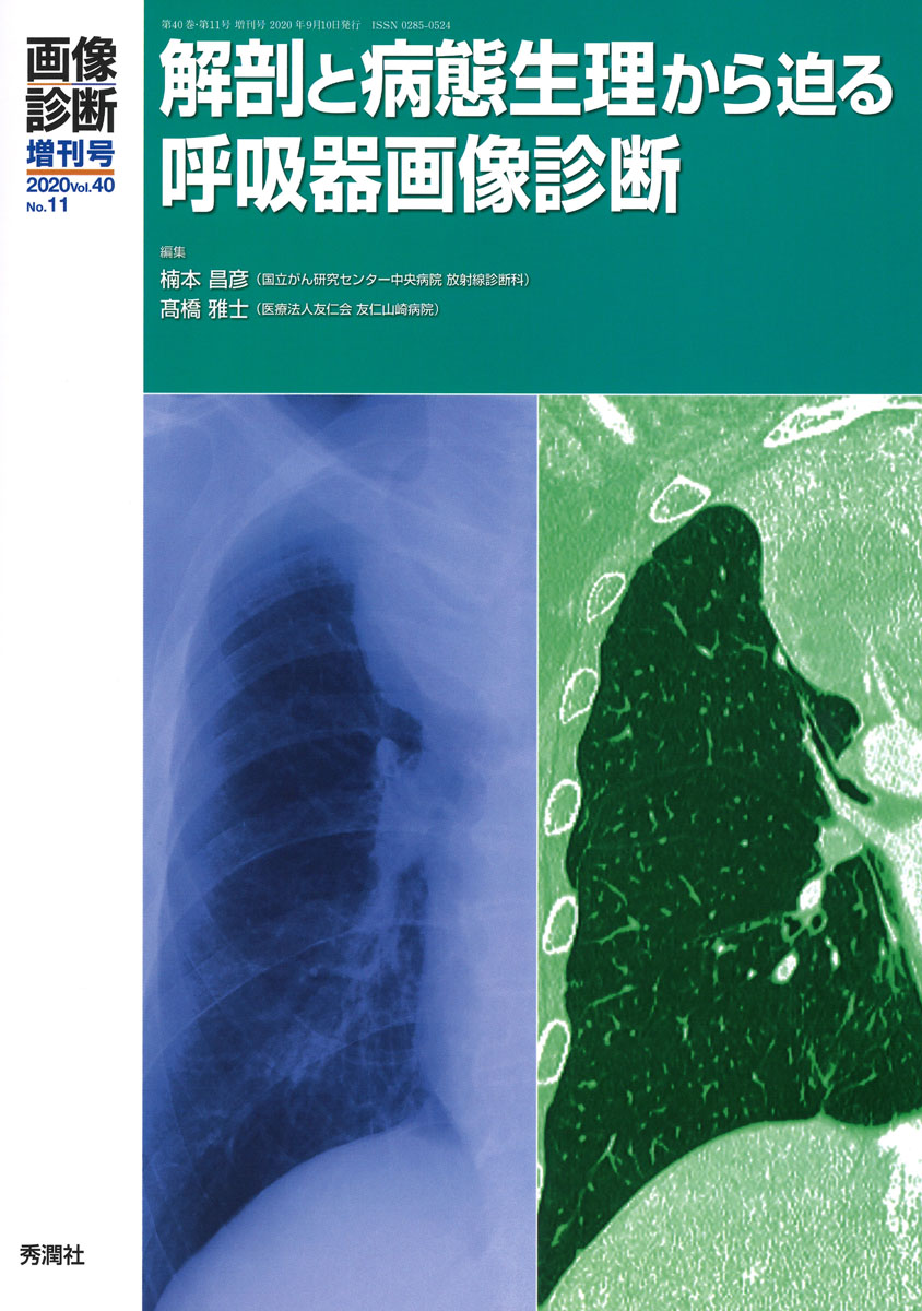 楽天ブックス: 画像診断2022年1月号 Vol．42 No．1 - 画像診断実行編集 