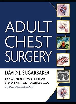 楽天ブックス: Adult Chest Surgery - David J. Sugarbaker - 9780071434140 : 洋書