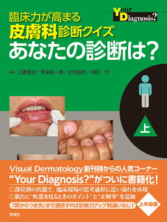 楽天ブックス 臨床力が高まる皮膚科診断クイズ 下 あなたの診断は 江藤隆史 本
