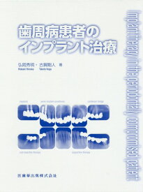 歯周病患者のインプラント治療 [ 弘岡秀明 ]