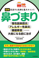 【読む常備薬】図解　見逃すと危険な重大サイン！！　鼻づまり