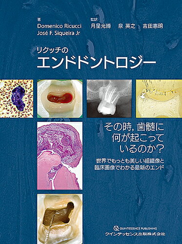 楽天ブックス: リクッチのエンドドントロジー - その時，歯髄に何が 