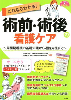 楽天ブックス これならわかる 術前 術後の看護ケア 中島恵美子 本