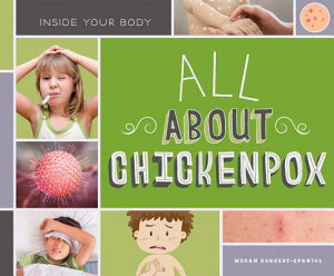 All about Chickenpox ALL ABT CHICKENPOX iInside Your Bodyj [ Megan Borgert-Spaniol ]