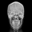 【輸入盤】2NDアルバム：アップセット