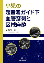 楽天ブックス: Hadzic