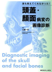 誰も教えてくれなかった！頭蓋・顔面病変の画像診断 [ 土屋一洋 ]