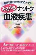 みるみるナットク血液疾患