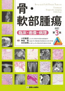 骨・軟部腫瘍　改訂第3版