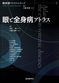 眼と全身病アトラス （眼疾患アトラスシリーズ　第5巻） [ 大鹿哲郎 ]