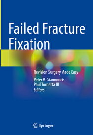 Failed Fracture Fixation: Revision Surgery Made Easy FAILED FRACTURE FIXATION 2024/ [ Peter V. Giannoudis ]