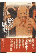 癌の歴史
