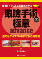 動画&イラスト&写真でわかる眼瞼手術の極意 advance 誰でもエキスパートになれる戦略書 [ 小久保 健一 ]