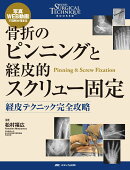骨折のピンニングと経皮的スクリュー固定