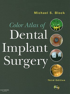 楽天ブックス: Color Atlas of Dental Implant Surgery [With DVD] - Michael S ...