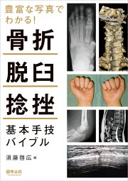 楽天ブックス: 新版 橈骨遠位端骨折 - 進歩と治療法の選択 The Cutting 