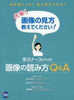 楽天ブックス 学ぶナースのための画像の読み方q A 何が起こった 私に何ができる 先輩 画像の見方教え 金井信恭 本
