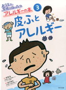 おうちで学校で役にたつアレルギーの本(3)