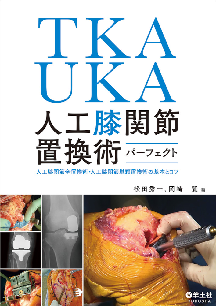 TKA・UKA 人工膝関節置換術パーフェクト-