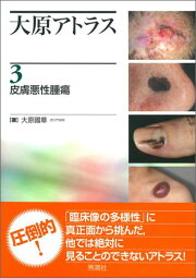 楽天ブックス: 大原アトラス3皮膚悪性腫瘍 - 大原 國章 
