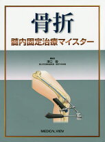 楽天市場】骨折髄内固定治療マイスターの通販 
