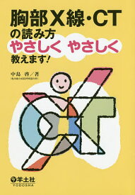 楽天市場 胸部x線 Ct 読み方の通販