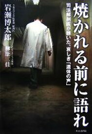 【中古】 焼かれる前に語れ 司法解剖医が聴いた、哀しき「遺体の声」／岩瀬博太郎，柳原三佳【著】