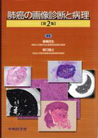 【中古】 肺癌の画像診断と病理　第2版／櫛橋民生(著者)