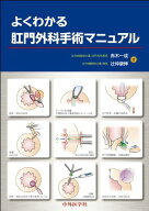 よくわかる肛門外科手術マニュアル