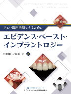 正しい臨床決断をするためのエビデンス・ベースト・インプラントロジー 小田 師巳; 園山 亘