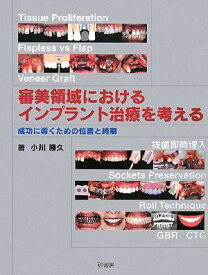 審美領域におけるインプラント治療を考える―成功に導くための位置と時期 小川 勝久