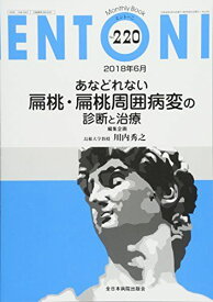 あなどれない扁桃・扁桃周囲病変の診断と治療 (MB ENTONI(エントーニ))