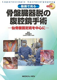 動画で見る 骨盤臓器脱の腹腔鏡手術?仙骨腟固定術を中心に