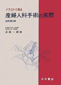 イラストで見る産婦人科手術の実際 改訂第2版