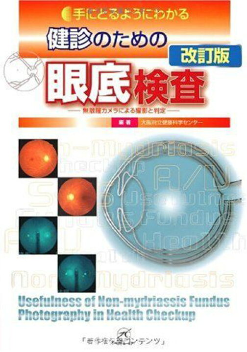 楽天市場】健診のための眼底検査 改訂版?無散瞳カメラによる撮影と判定