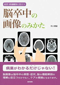 症状・経過観察に役立つ 脳卒中の画像のみかた