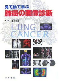 肺癌の画像診断―見て診て学ぶ [単行本] 憲業，本田