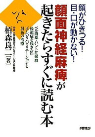 顔面神経麻痺が起きたらすぐに読む本