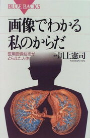 【中古】画像でわかる私のからだ—医用画像技術がとらえた人体 (ブルーバックス)