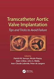 【中古】Transcatheter Aortic Valve Implantation: Tips and Tricks to Avoid Failure (Cardiology)