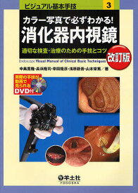 カラー写真で必ずわかる!消化器内視鏡 適切な検査・治療のための手技とコツ／中島寛隆／長浜隆司／幸田隆彦【3000円以上送料無料】