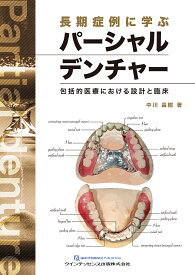 長期症例に学ぶパーシャルデンチャー 包括的医療における設計と臨床／中川昌樹【3000円以上送料無料】