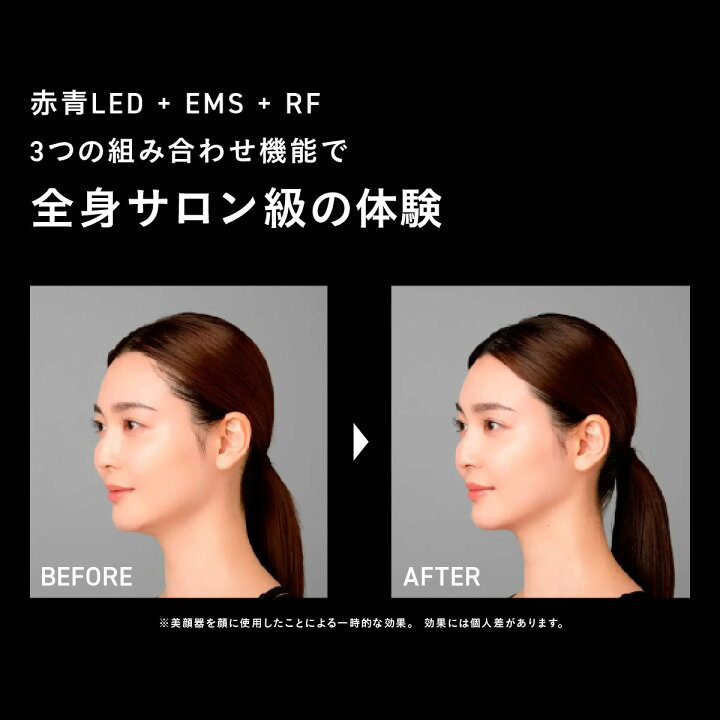 楽天市場】【リニューアル！】【公式】ブライト エレキブラシプラス  