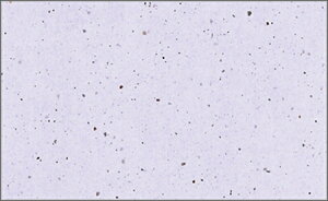 03963@Rӂ PʁF1i100j Ɩp Lb`pi ~[pi H  H n엿